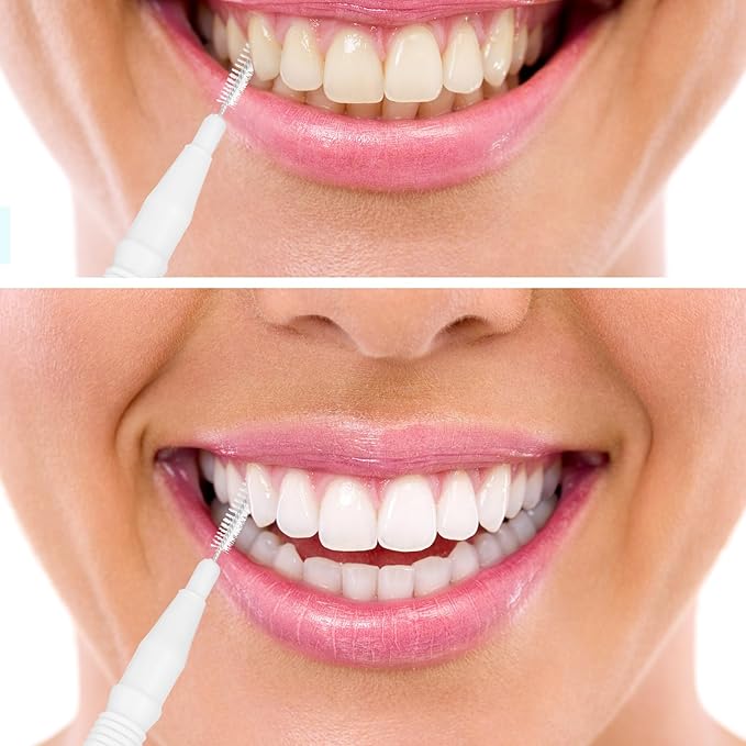 BBTO 100 Pcs Braces Dental Brush Flosser for Cleaner Interdental Brush Toothpick Tooth Flossing Head Oral Dental Toothpick Cleaners Cleaning Tool(Black, White)