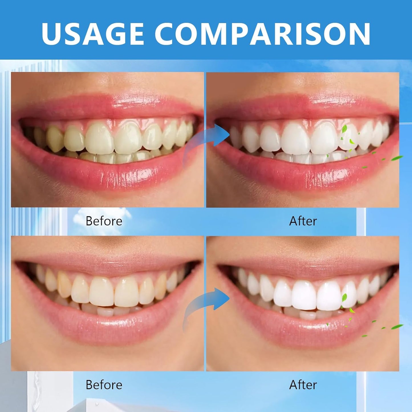 2025 New Sp-6 Probiotics Whitening Toothpaste-Fluoride-Free, Enhanced Formula with 6 Probiotics for Gum Care & Fresh Breath, Fresh Mint Flavor(2PC)（Blue）