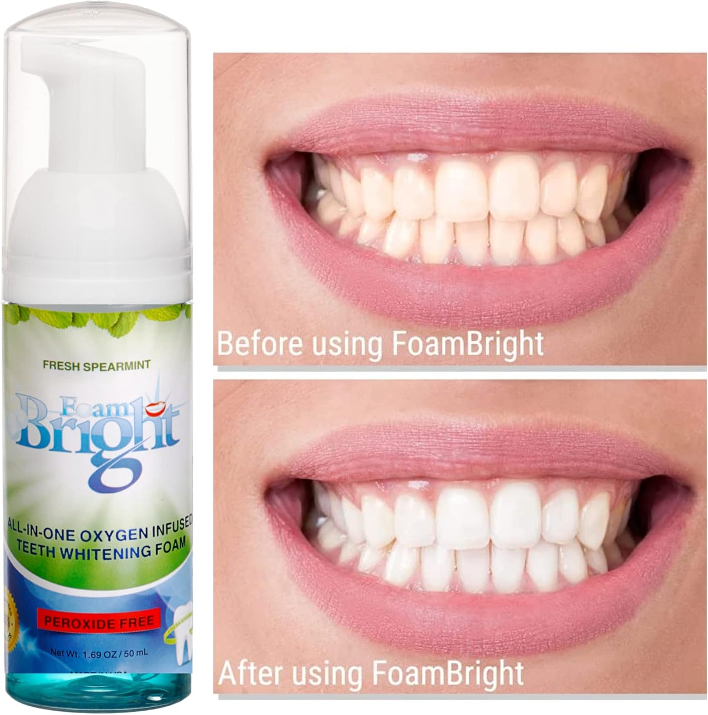 Retainer Foam Cleaner & Teeth Whitening Formula. The Ultimate Cleaning Toothpaste for Aligner Retainers. Great for All Kinds of Clear Retainers, Braces & Aligners. Safe for Dentures. (3 Pack)