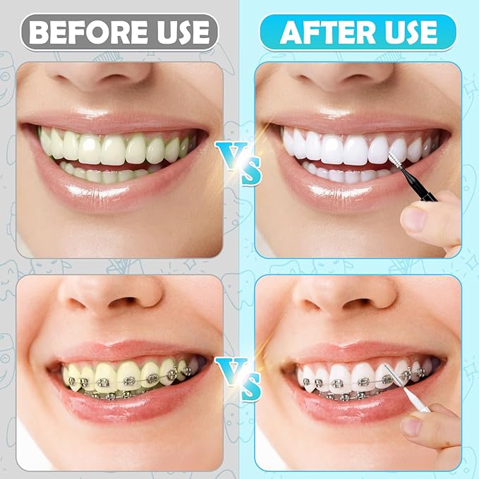 Modacraft 120Pcs Interdental Brushes, Deep Cleaning Flossers for Braces With Soft Bristles, 360 Bendable Floss Heads, Dental Brushes for Between Teeth, Gum and Orthodontic Oral Cleaning Tool Kit