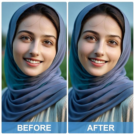 2PCS Natural Dimple Makers, White Facial Muscle Dimple Trainer Exerciser Lift Tools for Beautiful Smile