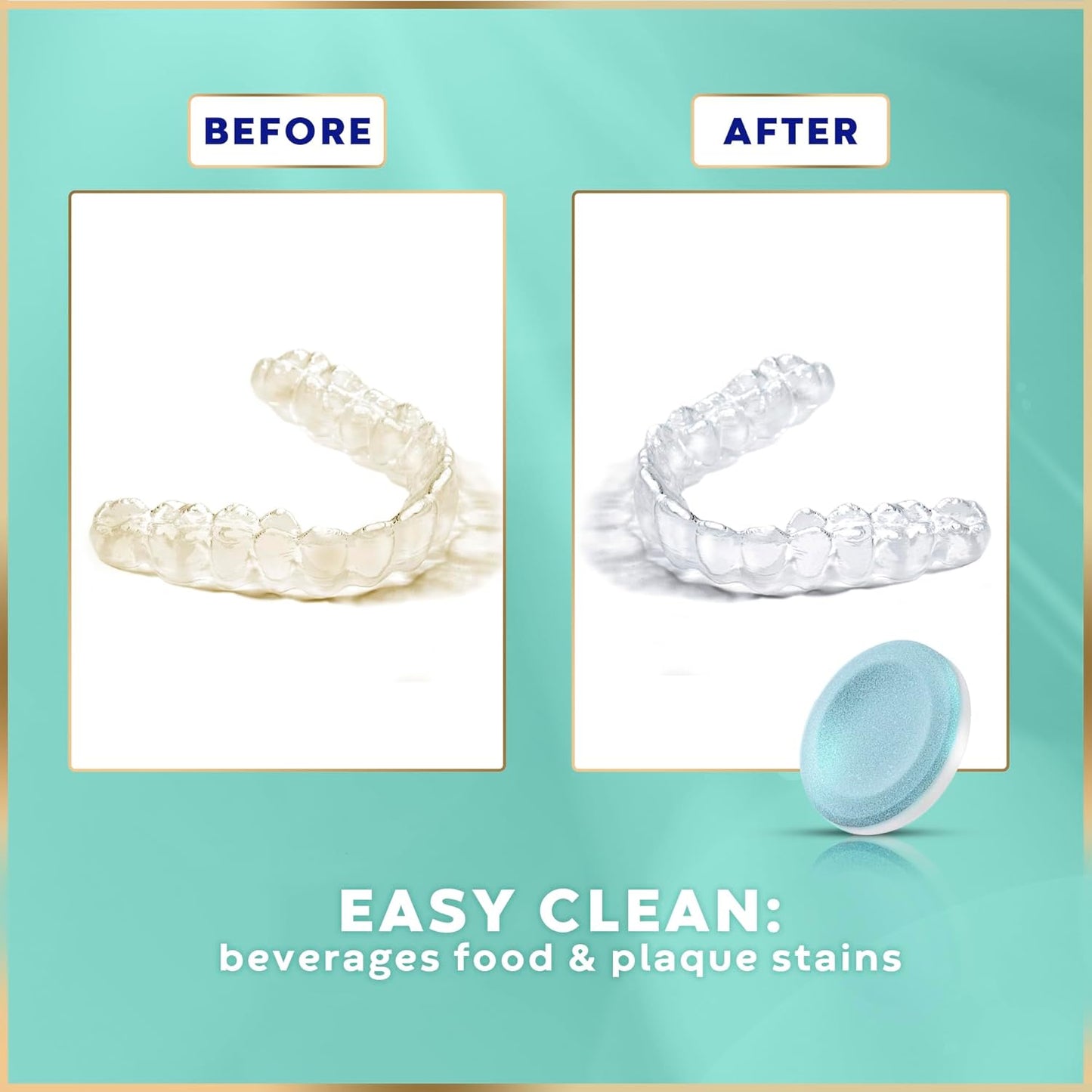 Retainer Cleaner Tablets - 120 Tablets (4 Months Supply) - Denture Cleaning, Removes Stains & Odours, Freshens Aligners, Mouthguards, Nightguards - Perfect for Ultrasonic Retainer Cleaner