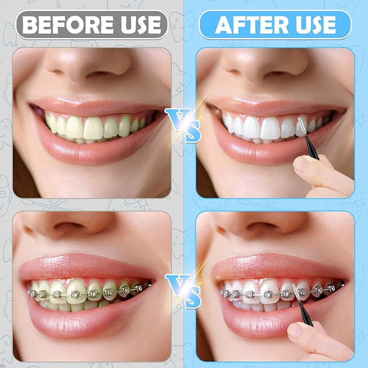 120Pcs Interdental Brushes, 360° Bendable Soft Bristles Braces Flossers Dental Brushes Between Teeth Gum Interdental Brushes for Gum Braces Oral Teeth Cleaning Tool （Black）