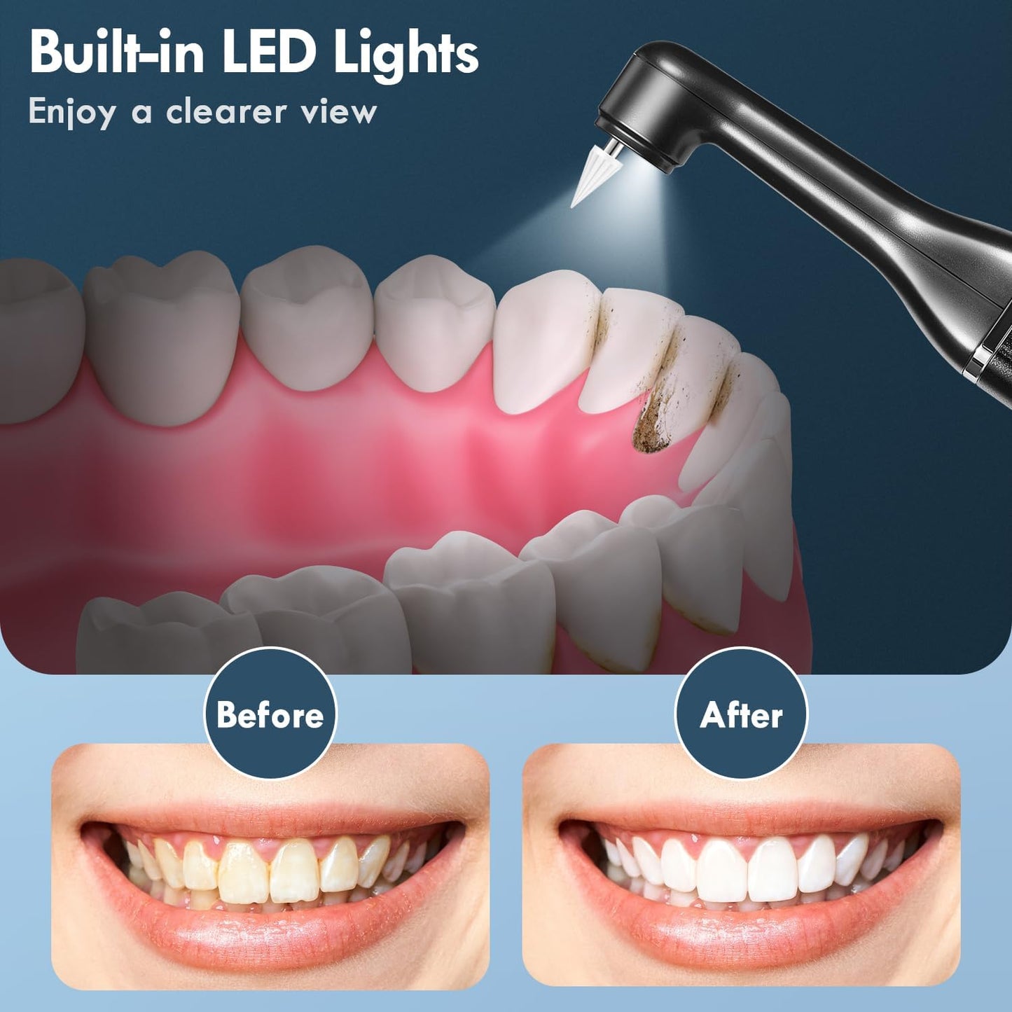 Tooth Polisher, Teeth Cleaning Kit with 5 Brush Heads, 3 Tooth Polish Paste, LED Light, IPX6, 5 Speed Modes, Rechargeable Professional Tooth Polishing Kit for Teeth Cleaning