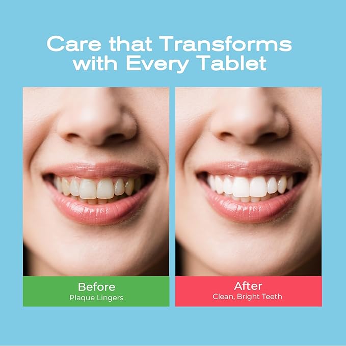 Happy Cleaner Toothpaste Tablets – Mixed Pack (Watermelon Mint + Mint Lime), Fluoride-Free, Nano Hydroxyapatite, Travel-Friendly Chewable Toothpaste, 60 Tablets Total