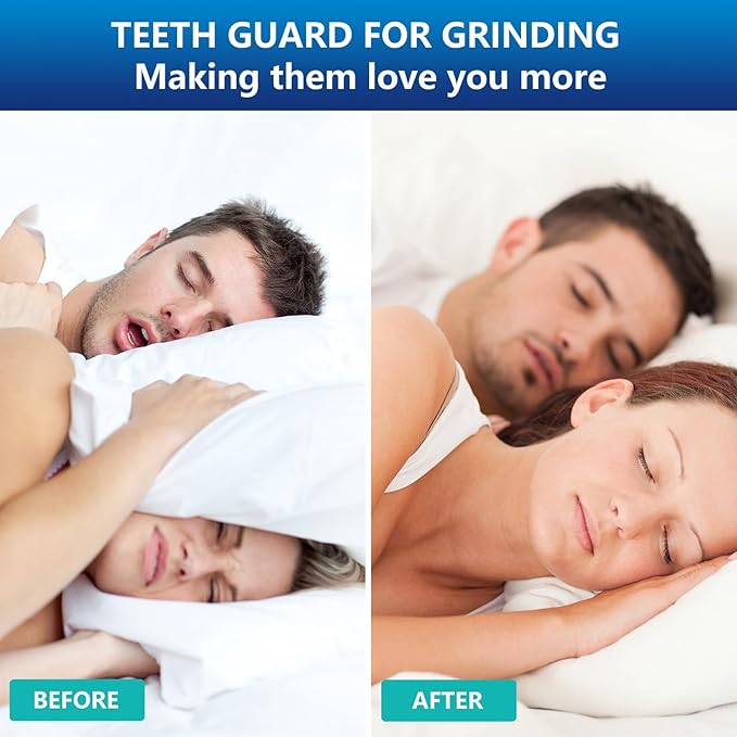 Mouth Guard for Grinding Teeth at Night, Night Guards for Teeth Grinding, Mouthguards for Grinding of Teeth, Mouth Guard for Clenching Teeth at Night with 12 Cleaning Tablets
