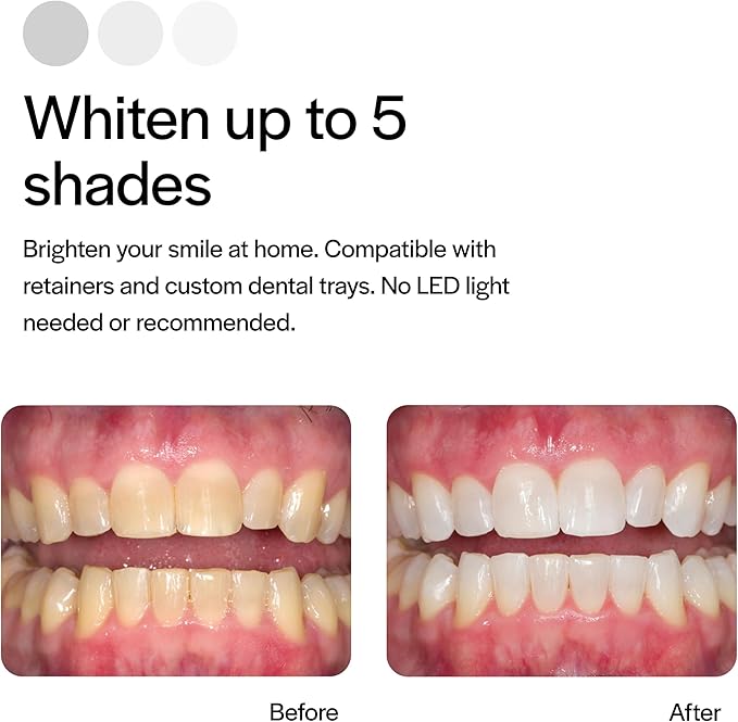 Opalescence 15% Gel Syringes Teeth Whitening Refill Kit - Low Sensivity (4 Syringes) - Cool Mint - Carbamide Peroxide - Made in The USA by Ultradent Tooth Whitening 5195-2