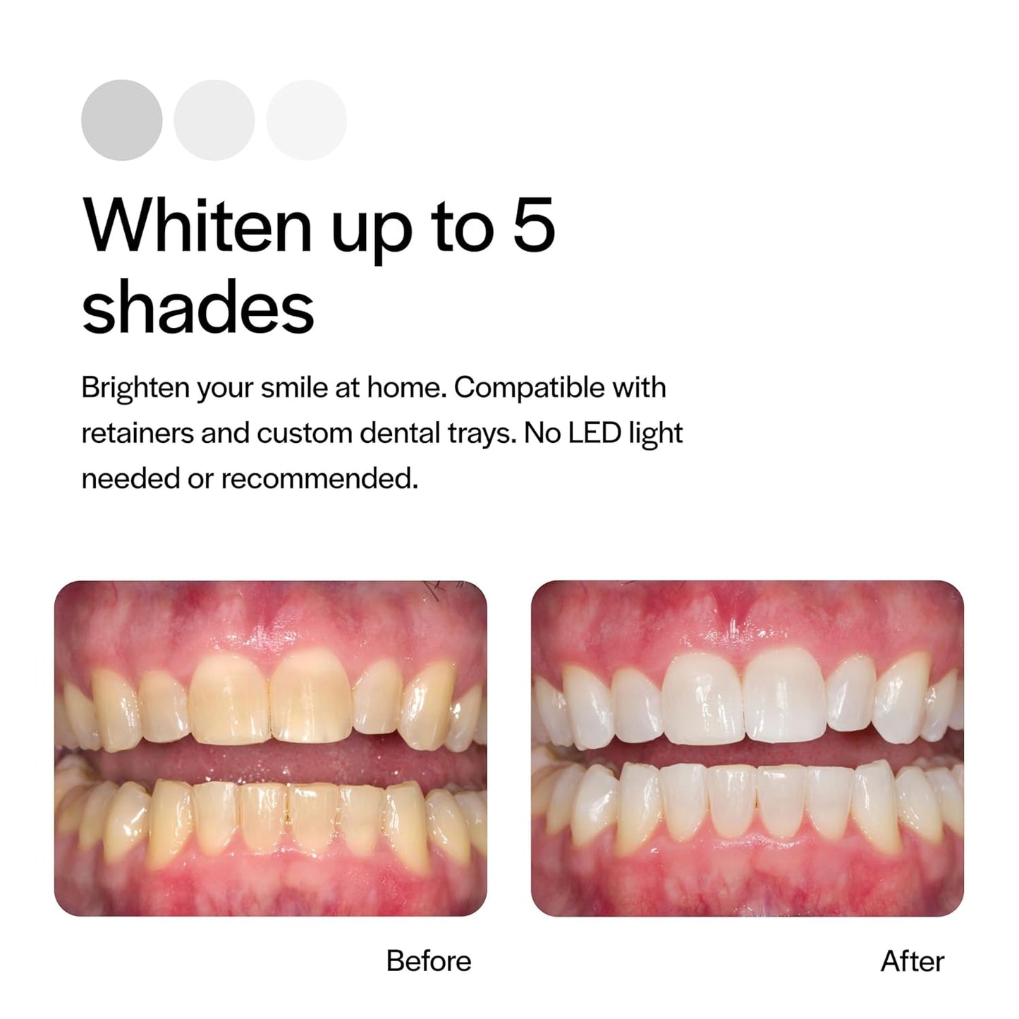 Opalescence 15% - Gel Syringes Teeth Whitening Refill Kit - Low Sensivity (8 Syringes) - Carbamide Peroxide - Cool Mint- Made in The USA by Ultradent - Tooth Whitening 5195-4