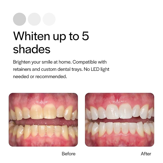 Opalescence 20% Teeth Whitening Refill Kit (4 Syringes) Carbamide Peroxide. Made by Ultradent, in Mint Flavor. Tooth Whitening Refill Syringes - B-5196-4