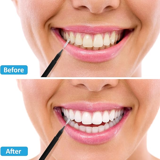 Patelai 100 Pieces Braces Brush for Cleaner Interdental Brush Toothpick Dental Tooth Flossing Head Oral Dental Hygiene Flosser Toothpick Cleaners Tooth Cleaning Tool (Black, Grey,Suitable Size)