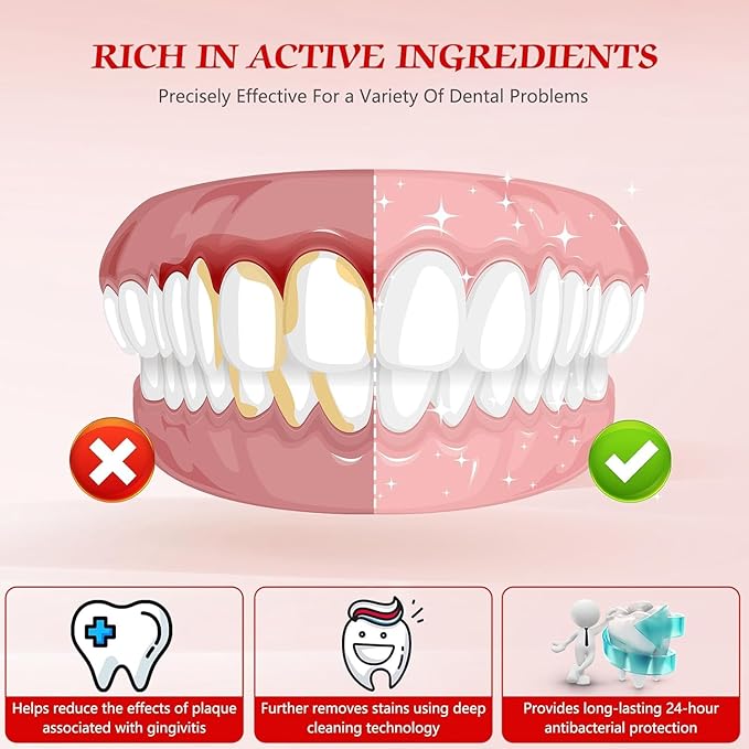 SP-6 Probiotic Whitening Toothpaste, Enhanced Formula with 6 Probiotics for Teeth Whitening and Gum Health, Enamel-Safe, Fluoride-Free, Fresh Mint Flavor, 4.6oz (3)