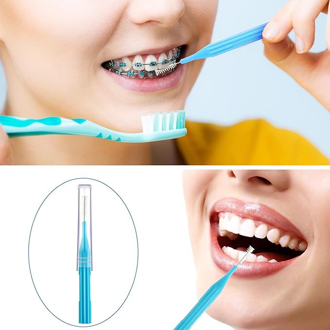 Patelai 100 Pieces Braces Brush for Cleaner Interdental Brush Toothpick Dental Flossing Head Oral Hygiene Flosser Tooth Cleaning Tool (Light Blue)