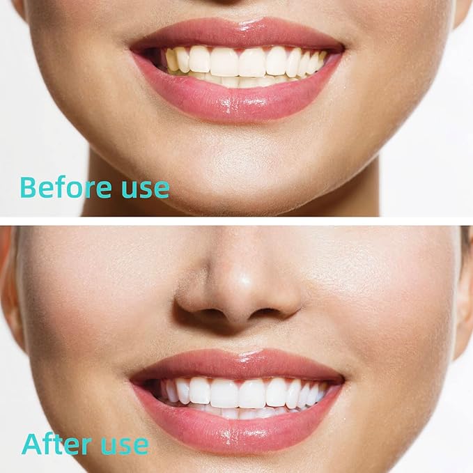 GOUWEIBA 100 pcs Braces Brush Disposable Interdental Brush Toothpick Dental Tooth Flossing Head Oral Dental Hygiene Flosser Dental Hygiene Flosser Tooth Cleaning Tools Oral Flossing Head (Blue+Red)