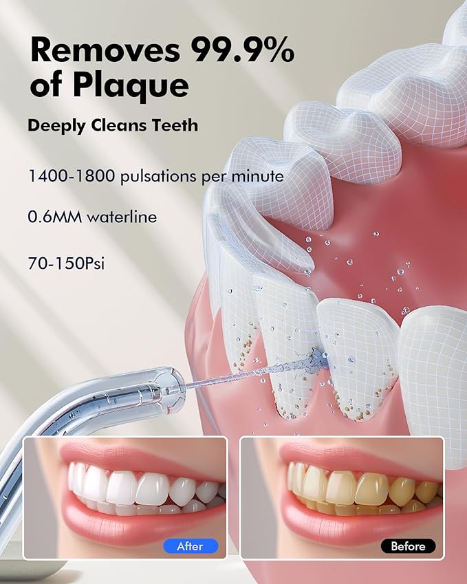 Water Flosser Teeth Pick: LED Display 5 Modes Cordless Dental Pick with 300ML Tank for Braces,Gums Care, IPX7 Waterpoof, 6 Jet Tips Water Flossing Cleaning Picks, Portable for Travel, Home, Y215 White