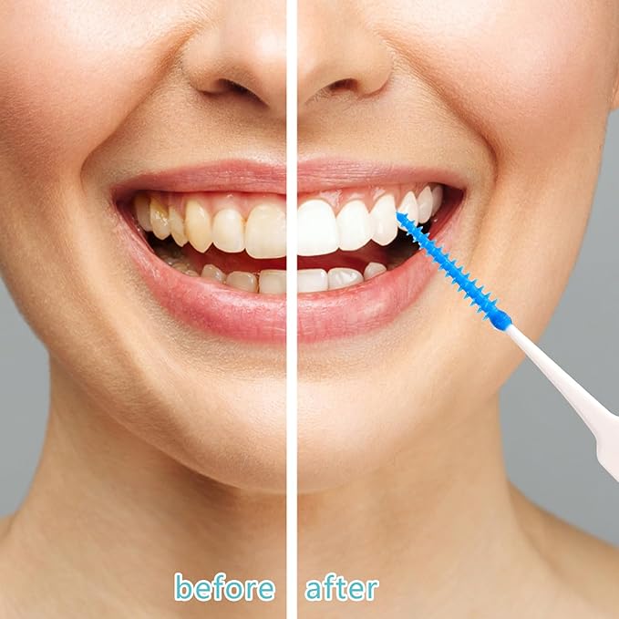100 Pieces Interdental Brushes, Silicone Dental Floss Picks with Case Dental Brushes Dental Picks Blue Tooth Floss Picks for Teeth Cleaning