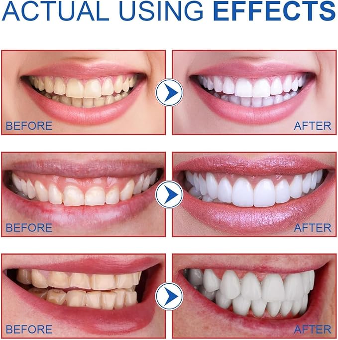 Niacinamide Whitening Toothpaste, Easilyous Radiant Whitening Toothpaste,Fresh Breath,Remove Tooth Stains, 2 Pack