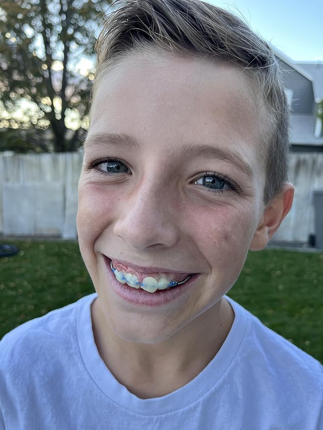 Organic Orthodontic Wax – Natural Braces Protection, Long-Lasting Comfort, Pre-Cut Wax Pieces in Aluminum Travel Case (75 Buttons) - Orange Clove