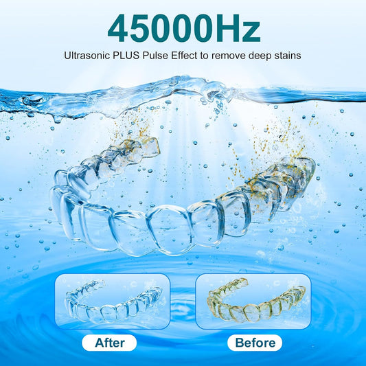 Ultrasonic Retainer Cleaner, Retainer Cleaner Machine Denture Cleaning Pod for Mouth Guards|Aligners|Braces|Toothbrush Heads|Jewelry, 45kHz with Digital Timer