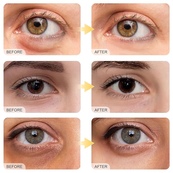 Jakuva Under Eye Patches (40 Pairs), 4 Colors Collagen & Hyaluronic Acid Eye Masks Set for Dark Circles, Puffy Eyes,Wrinkles,Moisturizing Face Masks Skincare Eye Spa for Woman & Men Gift