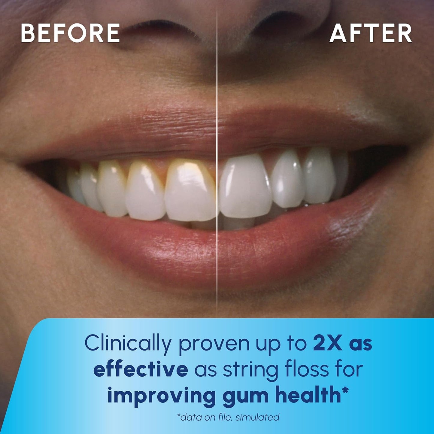 Waterpik Cordless Pulse Rechargeable Portable Water Flosser for Teeth, Gums, Braces Care and Travel with 2 Flossing Tips, Waterproof, ADA Accepted, WF-20 Gray, Packaging May Vary