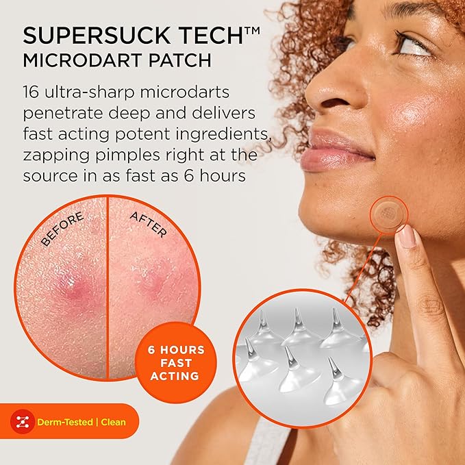 ZitSticka Killa Pimple Patches for Face - World's Most Potent Pimple Patch with Fast-Acting Microdarts - Starts Working within 6 Hours for Deep, Early-Stage Zits - Mini 4 Count