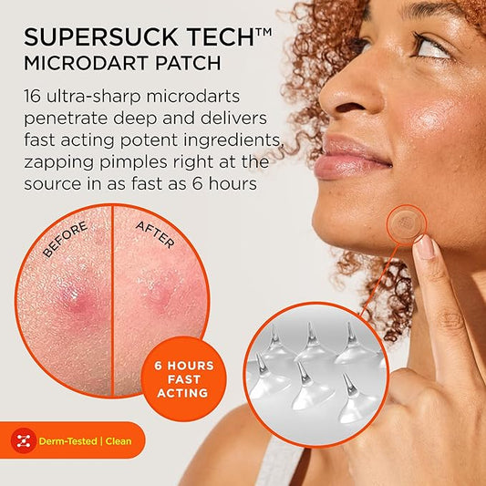 ZitSticka Killa Pimple Patches for Face - World's Most Potent Pimple Patch with Fast-Acting Microdarts - Starts Working within 6 Hours for Deep, Early-Stage Zits - Mini 4 Count