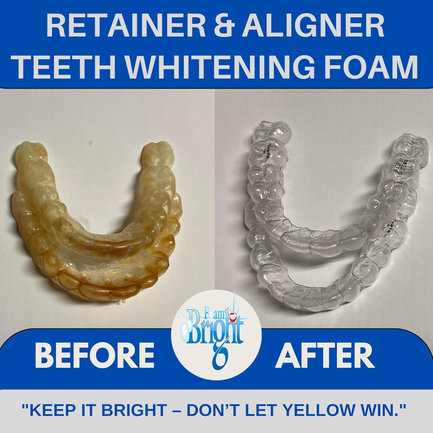 Aligner & Retainer Cleaner Foam Bright, Teeth Whitening Foam, Great for Invisalign, Candid, Byte, Night Guard, Mouth Guard, Dentures, Whitener, Toothpaste & Braces Cleaner, Peroxide Free