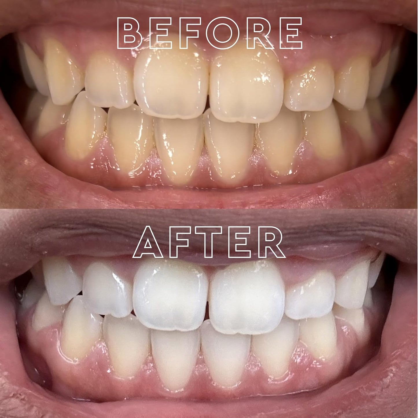 MOON Dissolving Teeth Whitening Strips, 56 No Rinse Nighttime White Strips, Midnight Mint, Enamel Pro+, Chamomile & Lavender, Whiten Sensitive Teeth up to 7 Shades in 4 Weeks, Vegan Oral Care