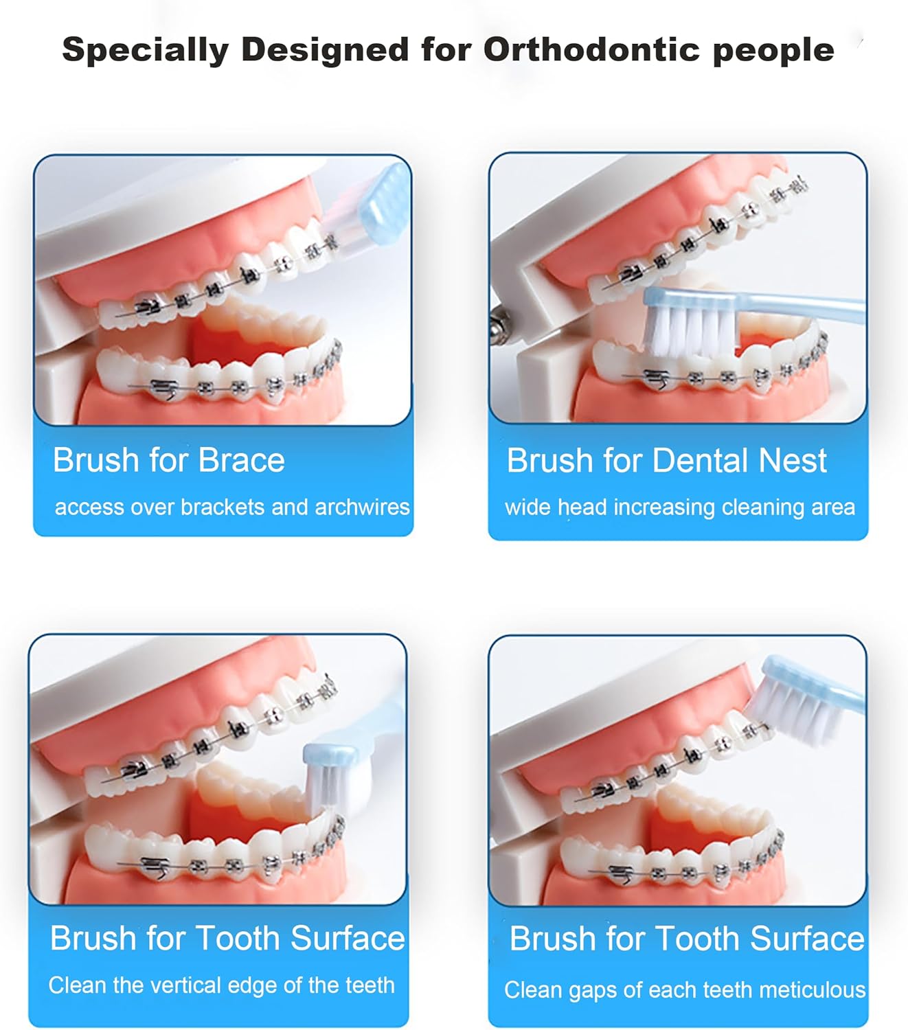 V-Shaped Orthodontic Toothbrush Dental Brush for Braces, for Kids/Teens/Adult, for Sensitive Teeth, for Delicate Gums, Soft Bristles, Toothbrush for Braces, with Tongue Cleaner, Blue, 3pcs