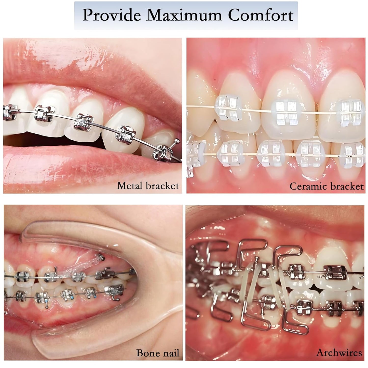 Orthodontic Wax for Braces 10 Boxes 50 Strip Odorless Braces Wax Dental Wax for Aligner, Dental Care, Prevent Mouth Injury