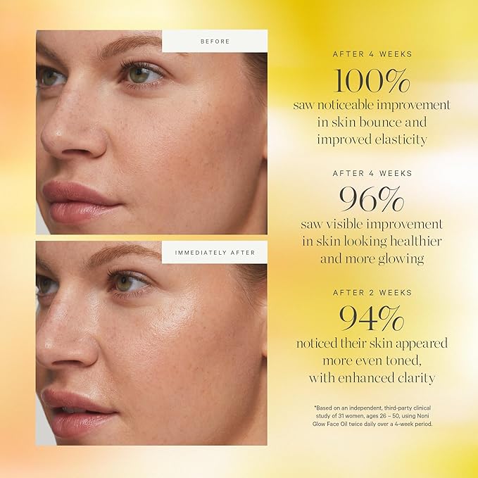 KORA Organics Noni Glow Hydrating Face Oil for Women with Rosehip, Gua Sha Oil, Certified Organic, Cruelty Free, 1.69 fl oz