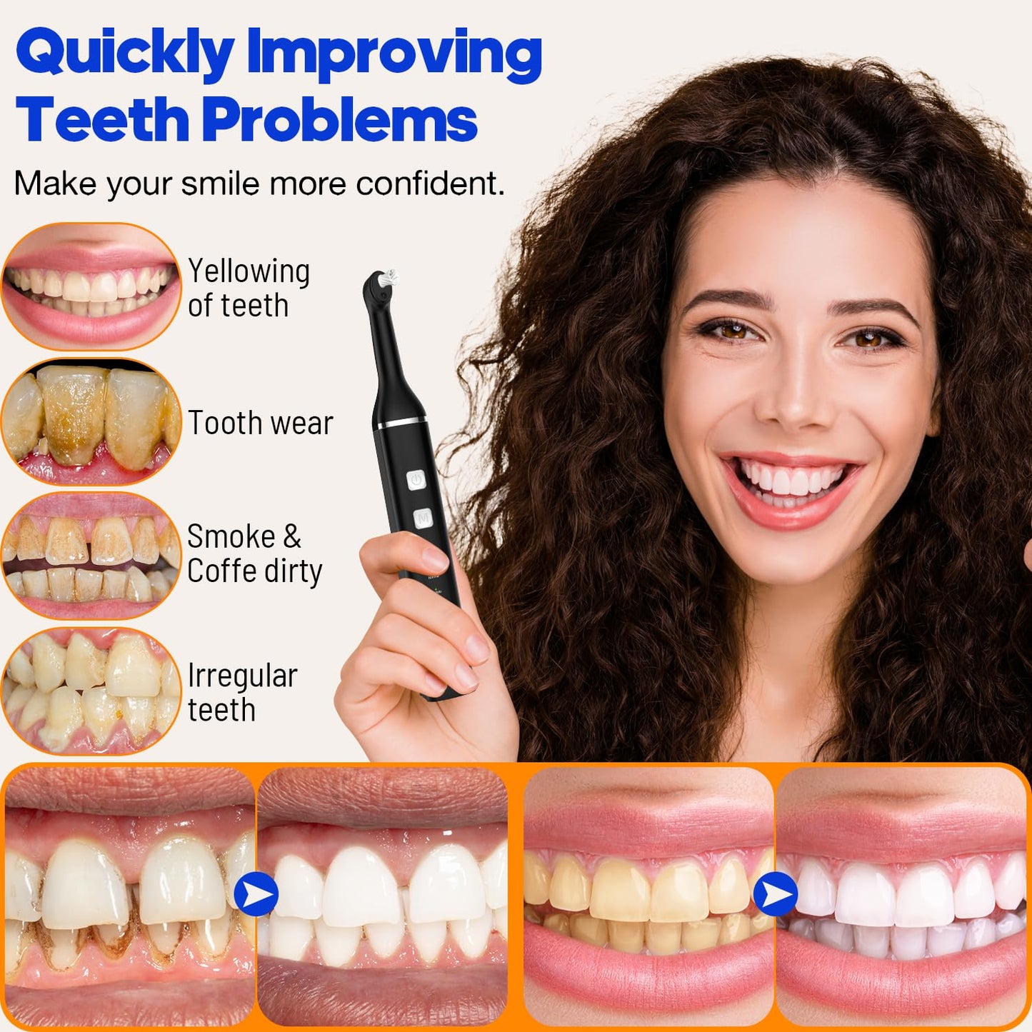 Tooth Polisher, RRZIOM Rechargeable Teeth Polisher for Teeth Whitening and Cleaning Kit, Waterproof Tooth Polish Dental Tools with LED Light, 5 Brush Heads, 5 Speed Modes, Tooth Polishing Kit