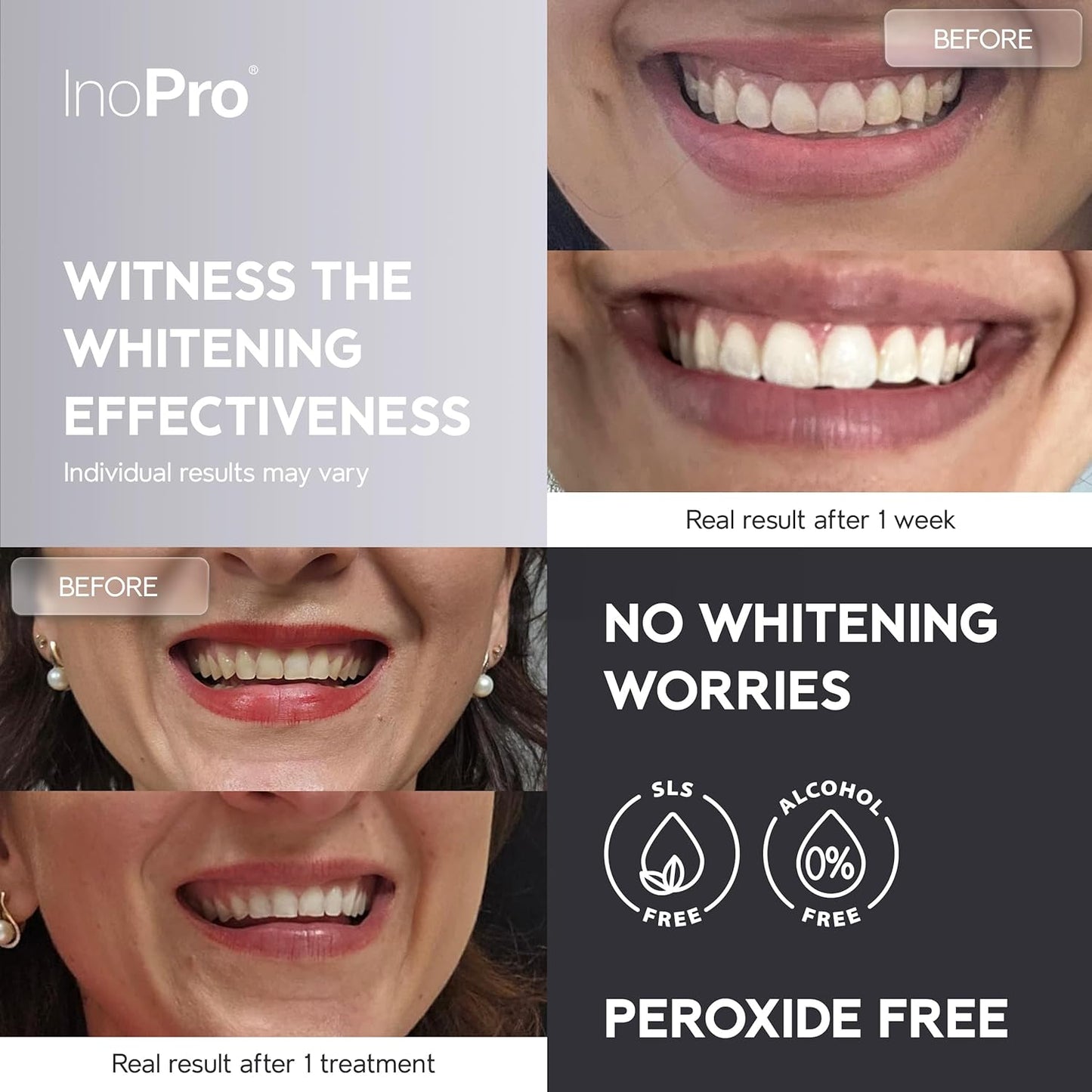 InoPro Natural Teeth Whitening Strips Kit 21 Treatments - Sensitive Teeth Whitener, Peroxide Free with Papain, Bromelain, Coconut Oil, White Strips for Teeth Whitening (42 Strips)