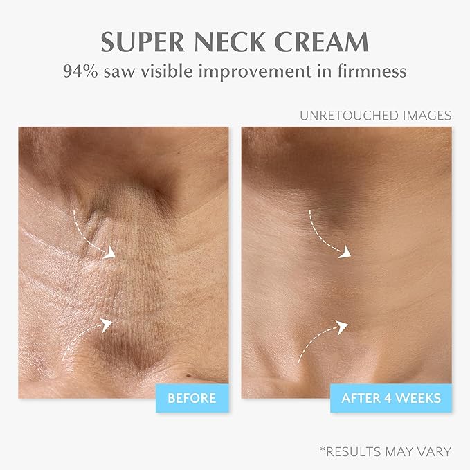 EnaSkin Retinol Collagen Face Cream: Wrinkle Cream for Women, Neck & Décolleté Anti Aging Moisturizer with 7% Hyaluronic Acid Serum - Day/Night Skin Firming & Tightening, 1.7 Oz