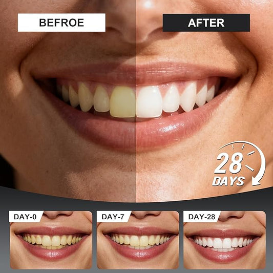 Woadee 7.5% Nano Hydroxyapatite Toothpaste Tablets - Remineralizing Enamel Repair, Fluoride-Free Whitening, Mint Fresh Travel Tabs (62 Count)