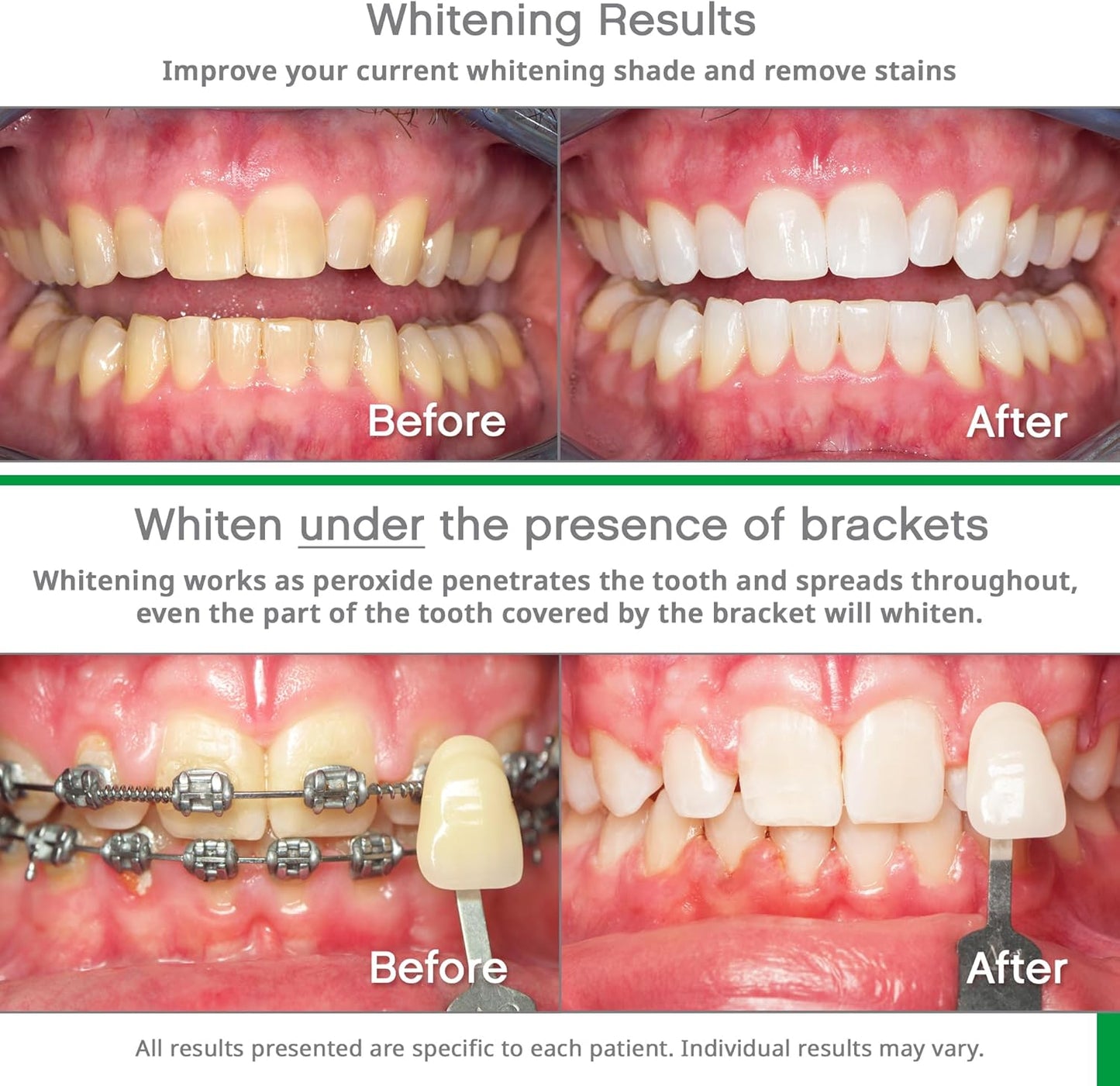 Opalescence Go - Prefilled Gel Teeth Whitening Trays (2 Packs / 20 Treatments) - 15% Hydrogen Peroxide - Teeth Whitening Kit -Mint - 5194-2