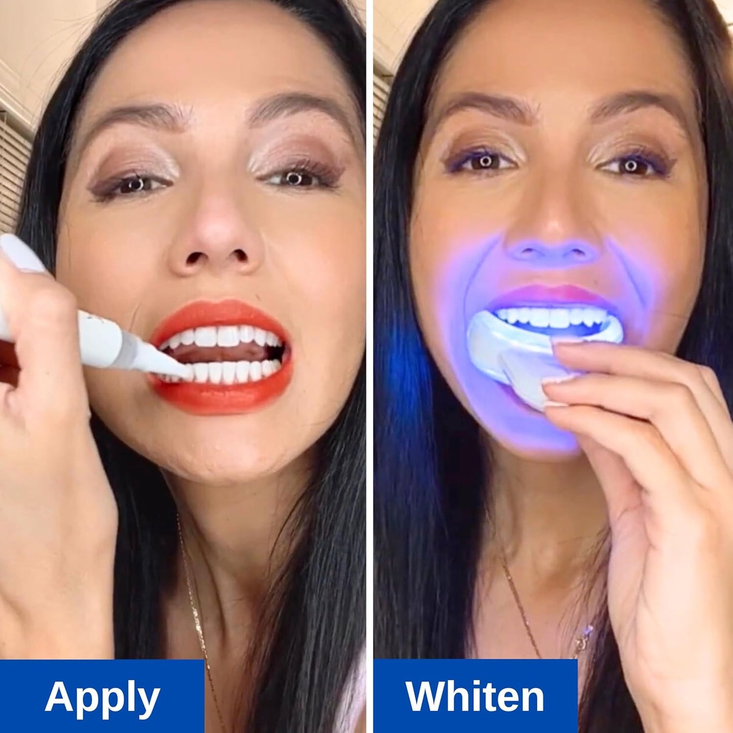 Polar MD Teeth Whitening Kit, Professional Teeth Whitener Gel Pens, 1YR. Supply, Compare to Whitening Strips. Powerful 32 LED Wireless Activating Light.