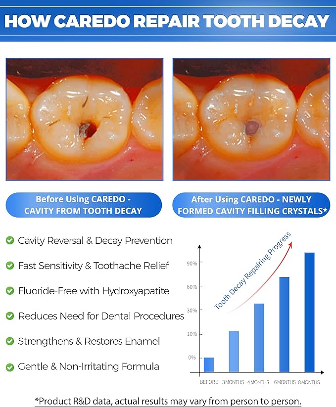 Cavity Repair Toothpaste Cure Tooth Cavities Dental Caries Remineralizing with Hydroxyapatite Toothpaste Treatment Tooth Decay for Adults, Home School or Travel (New Flavor 100g*1), Grey White