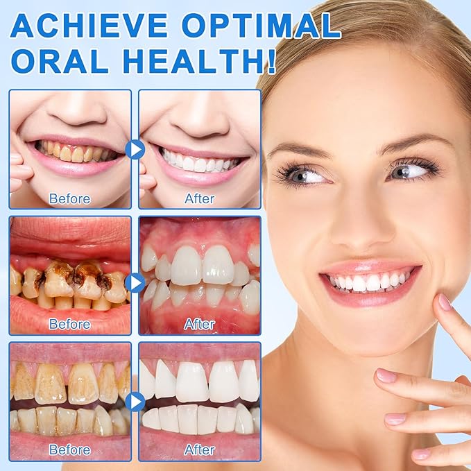 9.9% Hydroxyapatite Toothpaste, Nano Hydroxyapatite Toothpaste Protects Enamel and Strengthens Teeth, Cleans and Cares for Oral Health, Promotes Freshens Breath