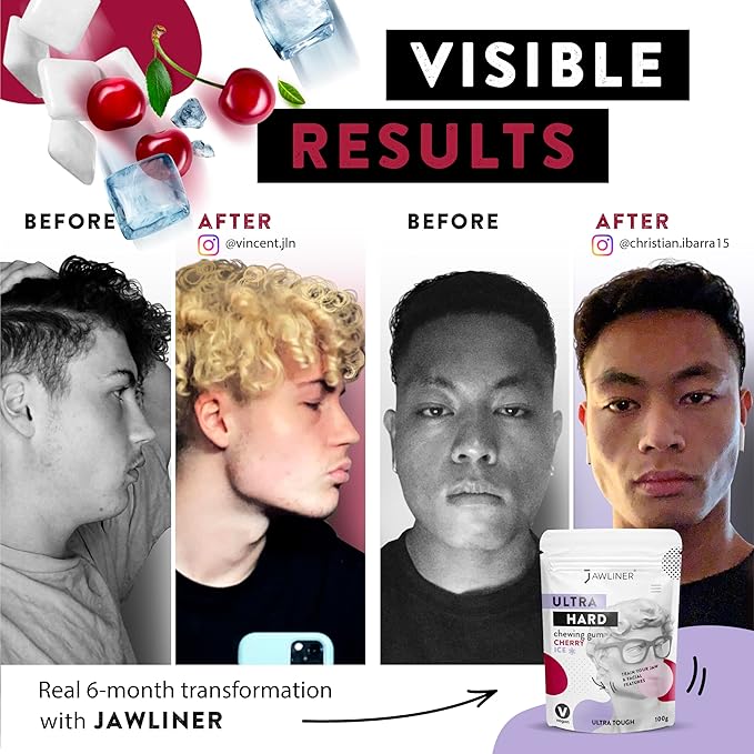 Jawliner® - Pioneers the Toughest Handmade 15x Harder Jawline Gum Includes 12 Weeks Coaching - Sugar-Free Cherry Ice Hard Gum - Jawline Exerciser Chewing Gum for Mewing & Shaping Jaw (2 Months Pack)