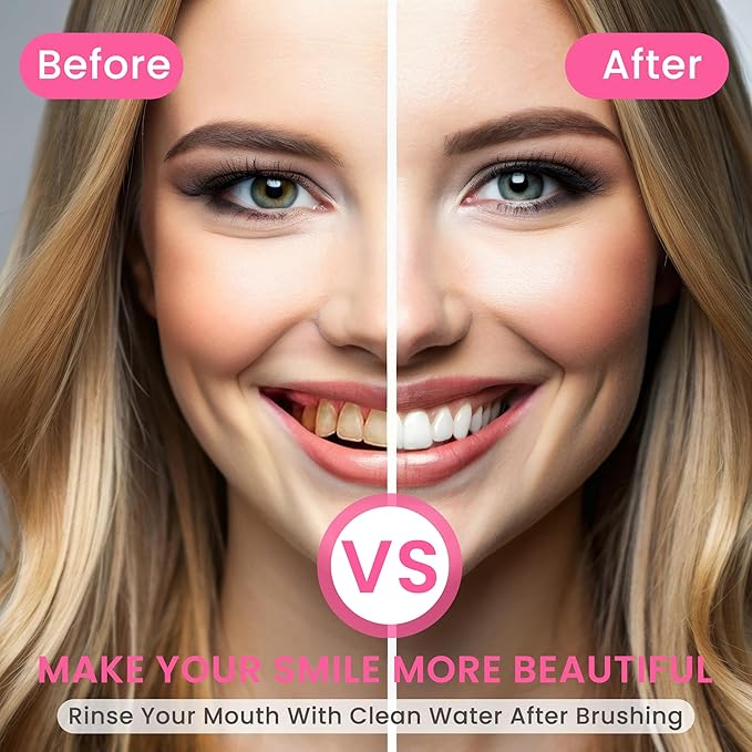 BodyAccel Niacinamide Whitening Toothpaste, Brightens and Whitens Teeth, Stain Removal Natural Gentle, Fresh Breath