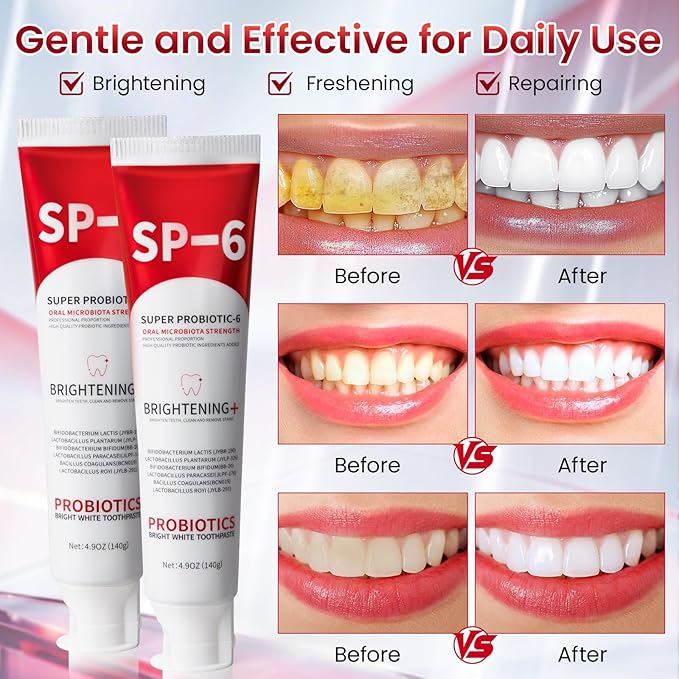 SP-6 Probiotic Whitening Toothpaste, SP-6 Probiotic Toothpaste, Enhanced Formula with 6 Probiotics for Teeth Whitening/Brightening, Enamel-Safe, Fluoride-Free, Fresh Mint Flavor, 4.9oz (1)