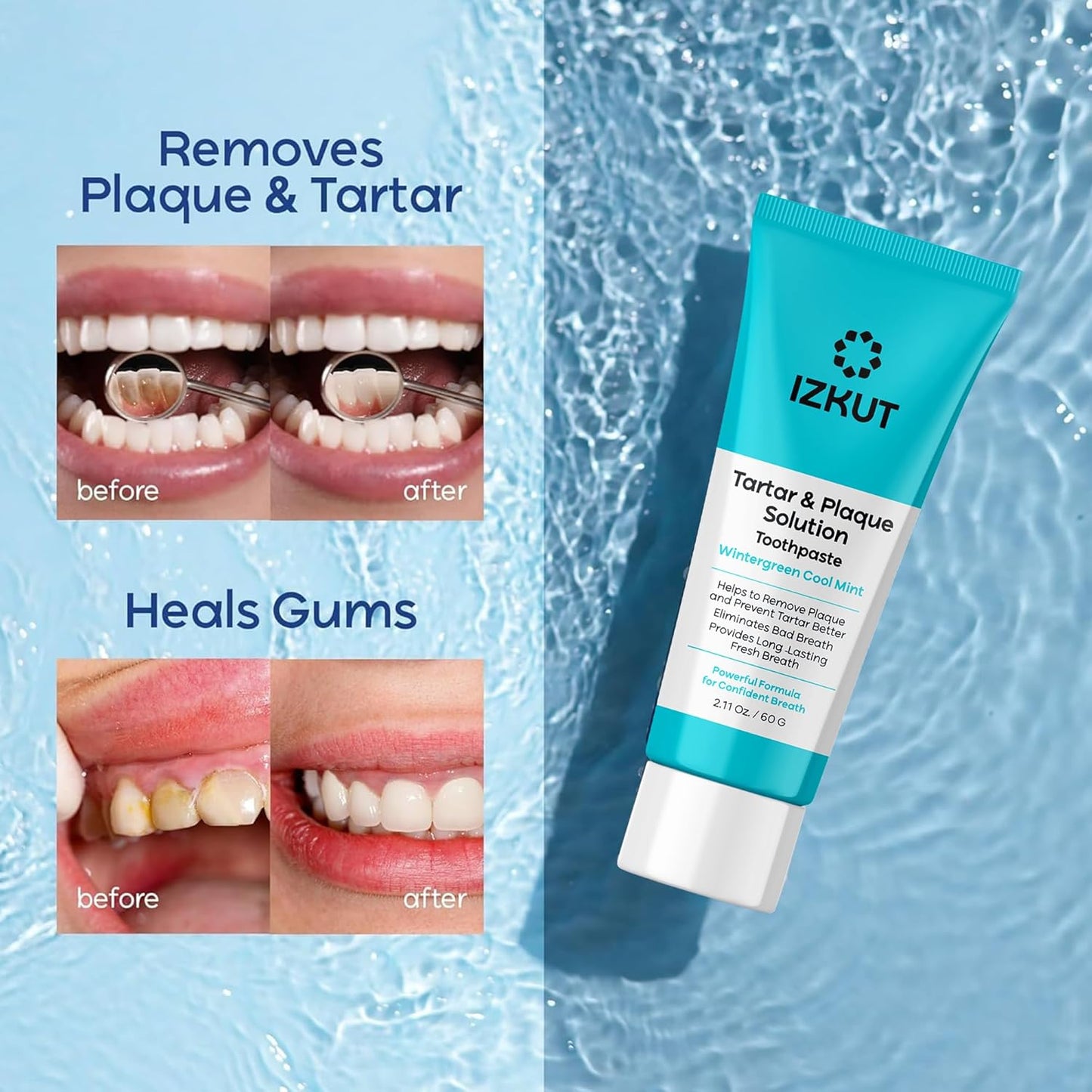 Plaque & Tartar Remover Toothpaste for Teeth: Removes Plaque & Controls Tartar Build-up - Long-Lasting Fresh Breath, Deep Cleansing & Gum-Friendly Formula (Wintergreen)