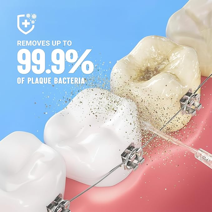 Portable Water Flosser for Teeth - 4 Modes Cordless Oral Irrigator with 300ML Tank, 360° Rotating Nozzle, 4 Jet Tips, Rechargeable, IPX7 Waterproof, Low Noise Gravity Ball Design (M159 - Black)