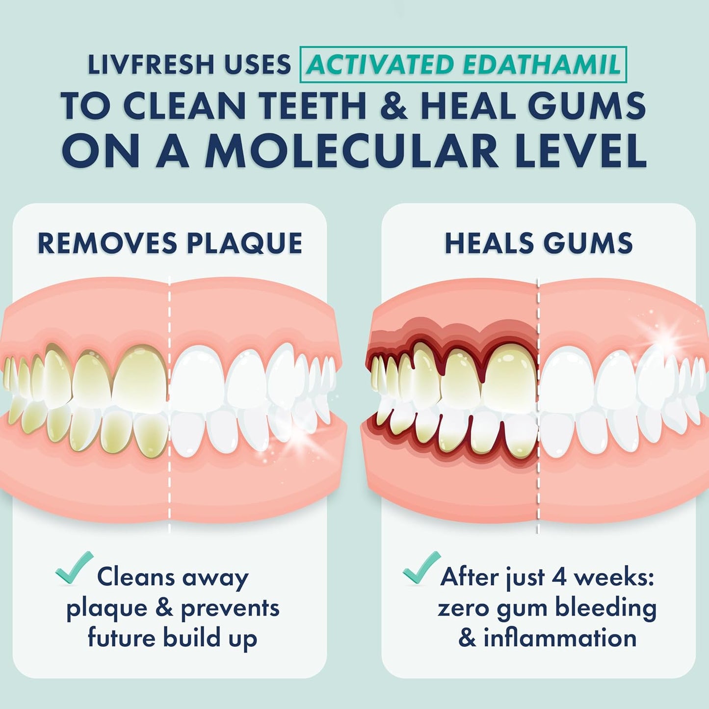 LIVFRESH Toothpaste Gel, Clinically Proven to Remove Plaque 250% Better, Improves Gum Health 190% Better, Prevents & Reduces Tartar, Freshens Breath, SLS Free Dental Gel, Wintergreen