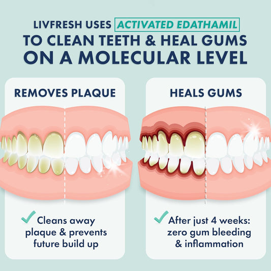 LIVFRESH Toothpaste Gel, Clinically Proven to Remove Plaque 250% Better, Improves Gum Health 190% Better, Prevents & Reduces Tartar, Freshens Breath, SLS Free Dental Gel, Wintergreen