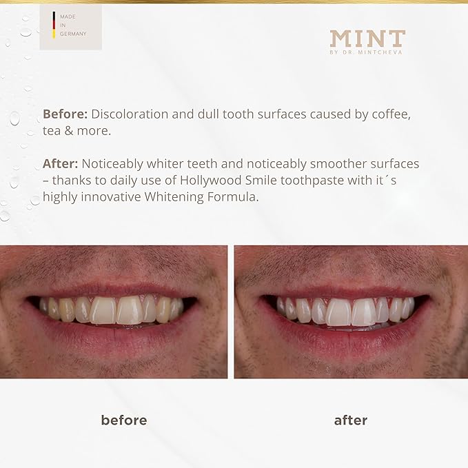 Mint Bright Smile Essential Set – Whitening Polishing Paste & Mouthwash – MPT1 Ultra Polish Technology with Perlite – Hydrogen Peroxide for Radiant Teeth – Vegan, Alcohol-Free, Microplastic-Free