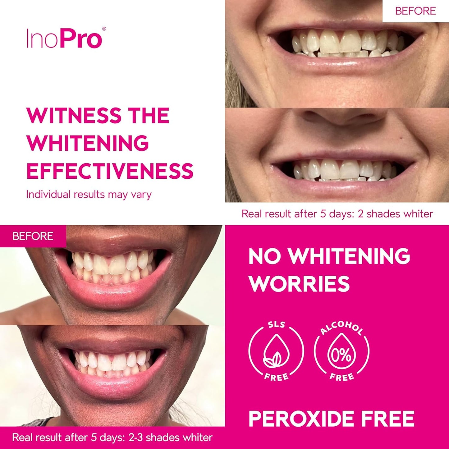 InoPro Teeth Whitening Strips 21 Treatments Kit - Teeth Whitener, Peroxide Free, Green White Strips for Teeth Whitening with Arbutin, Coconut Oil, Deep Stains Removal (42 Strips)
