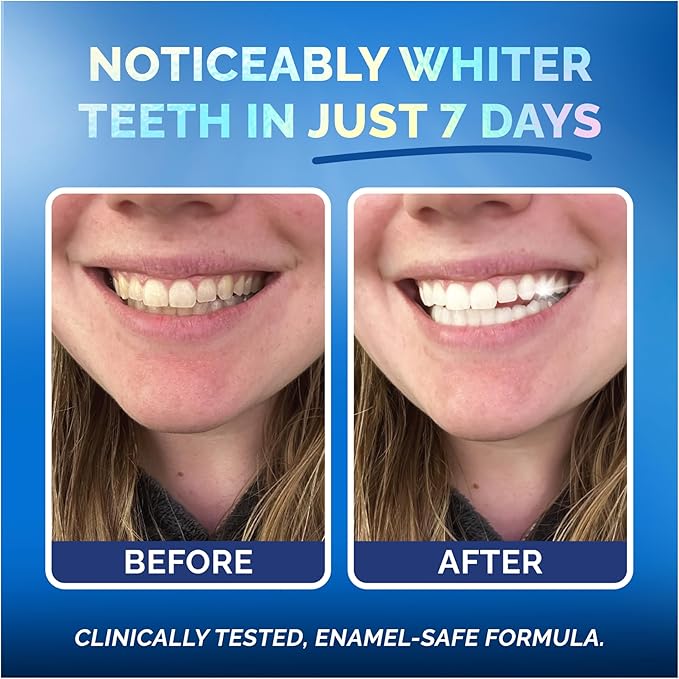 Whitening Strips for Sensitive Teeth 21 Treatments, Mint – Enamel Safe, Peroxide-Free Coconut Teeth Whitening Strips with Natural Enzymes – Gentle White Stips for Sensitive Gums & Daily Oral Care