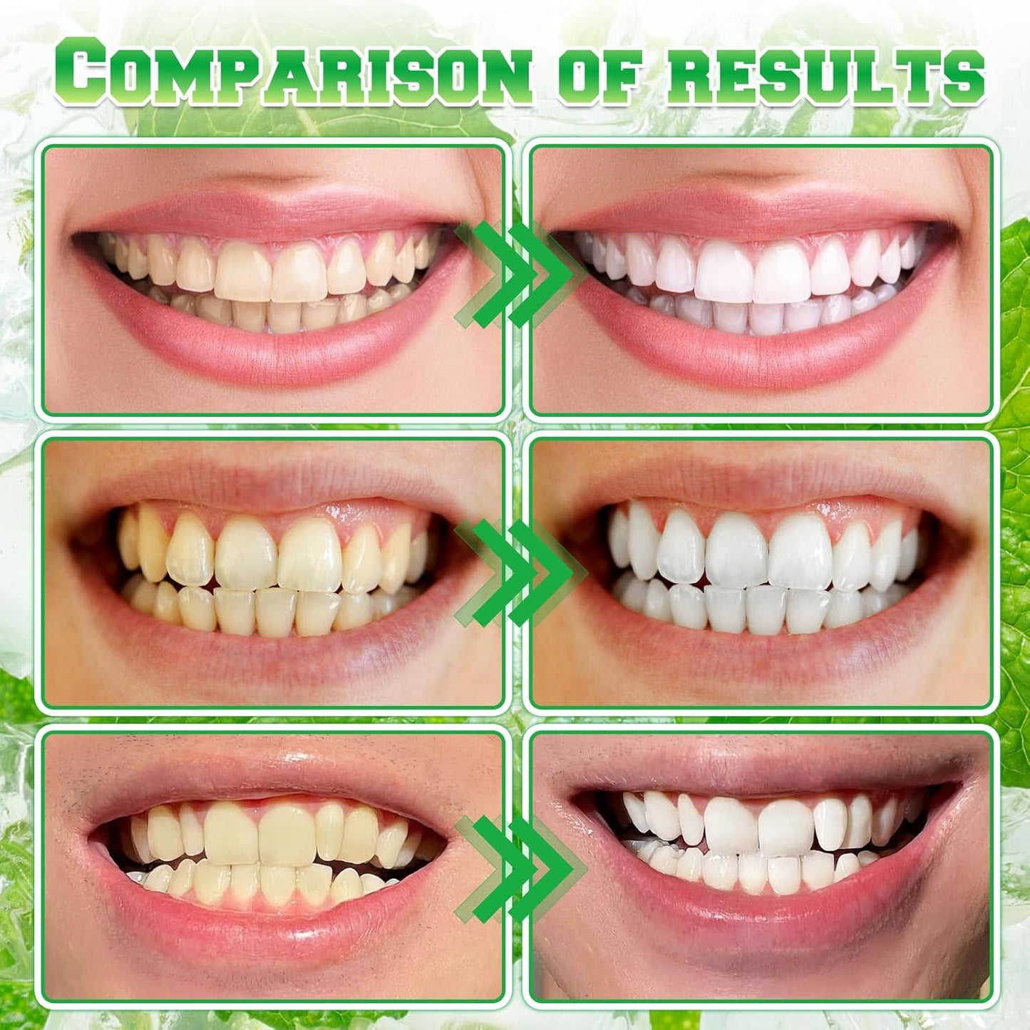 Spearmint Oil Pulling Rinse, Cold-Pressed Coconut Mouthwash for Teeth Whitening,Natural Peppermint Pulling Oil to Help Maintain Gum Health and Freshen Breath (1)